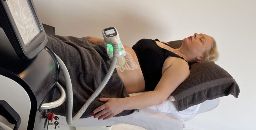 Fat Freezing Breda - Veilig vet bevriezen met Cryolipolyse