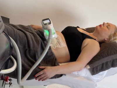 Fat Freezing Breda - Veilig vet bevriezen met Cryolipolyse