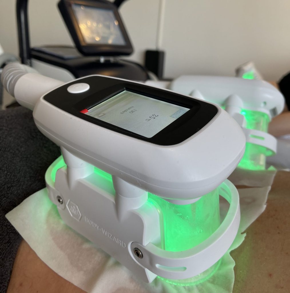 Fat Freezing Breda - Veilig vet bevriezen met Cryolipolyse