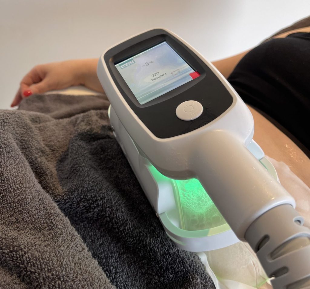 Fat Freezing Breda - Veilig vet bevriezen met Cryolipolyse