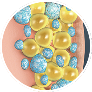 Cryolipolyse - Fat Freezing Breda